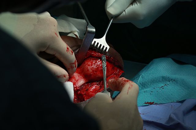 Surgical Operation